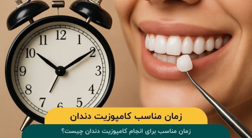 زمان-مناسب-کامپوزیت-دندان